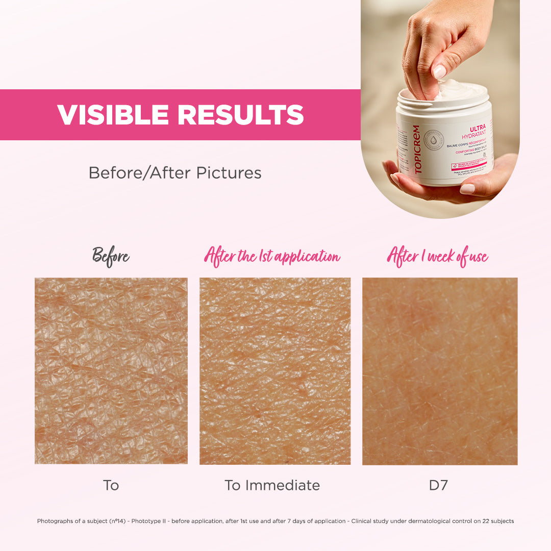 Topicrem Ultra-Moisturizing Comforting Body Balm 380ml