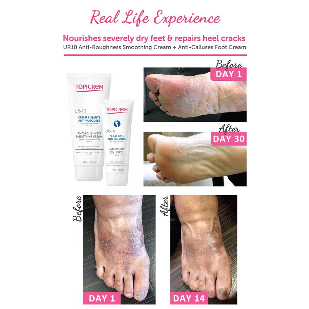 Topicrem UR10 - Anti-Roughness Smoothing Cream